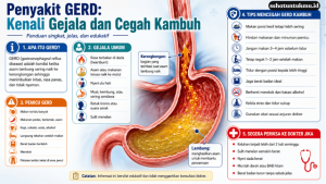 cara mengurangi gejala GERD